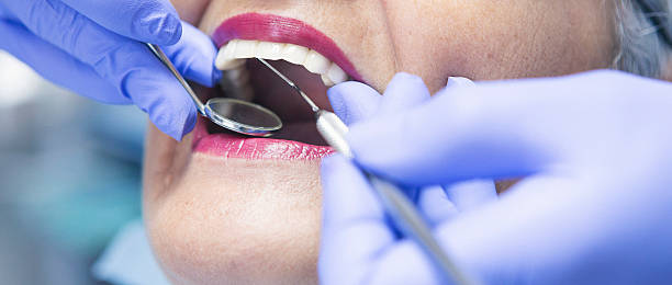 Best Emergency Dental Care for Broken or Chipped Teeth in Clinton, NY